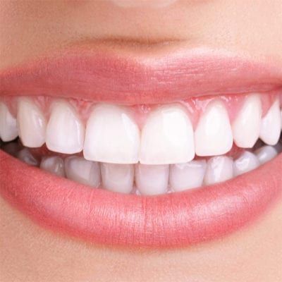 White teeth